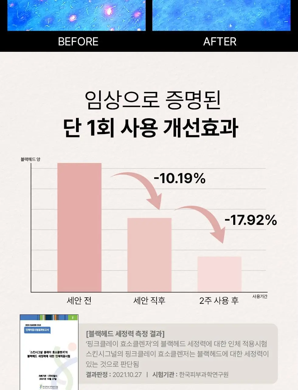 [머랭솝/팩브러쉬증정] 스킨시그널 클레이 효소클렌저 70g 팩브러쉬 증정기획 (핑크/그린) 상세페이지 33